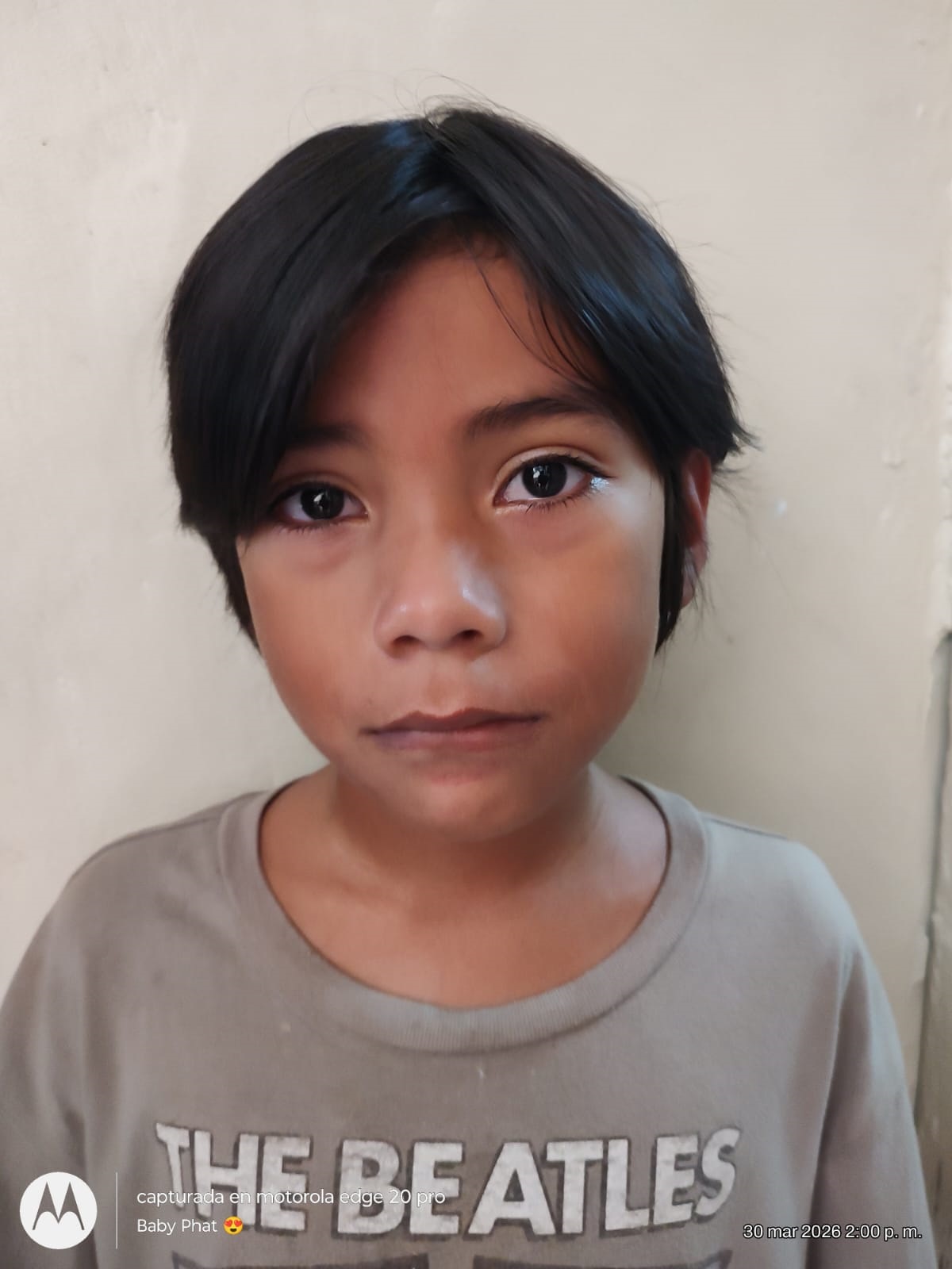 Benedict Paul  Escobar Duarte